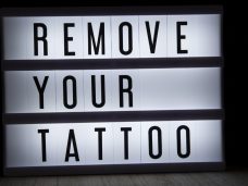 How Do Tattoo Removals Work