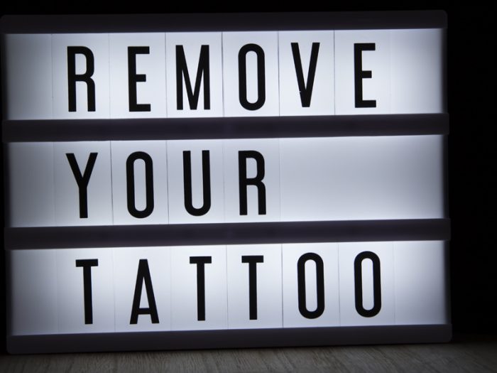 How Do Tattoo Removals Work
