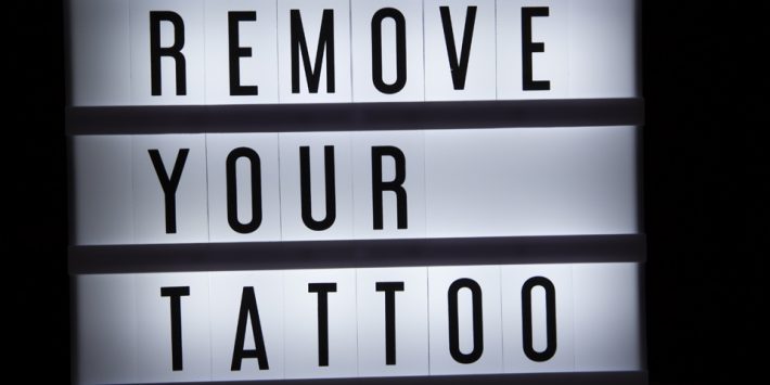 How Do Tattoo Removals Work